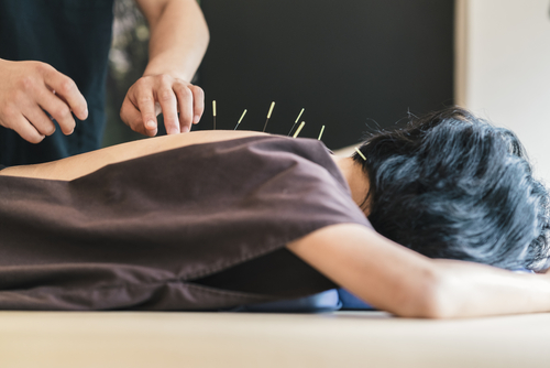 acupuncture for overall wellness